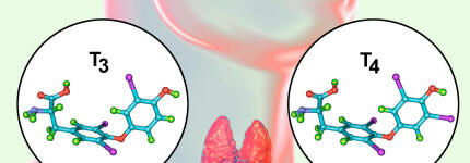 Schilddrüsenerkrankungen